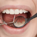 In Which Situations Should a Tooth Not Be Extracted?